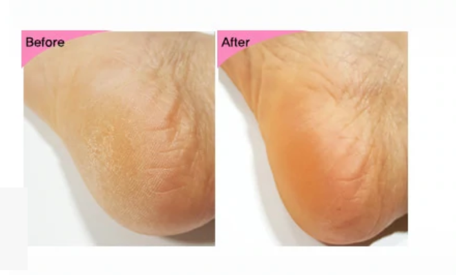 Esfolio foot & Heel Peeling mask